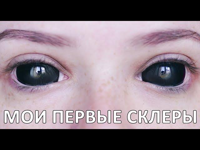 МОИ ПЕРВЫЕ СКЛЕРЫ