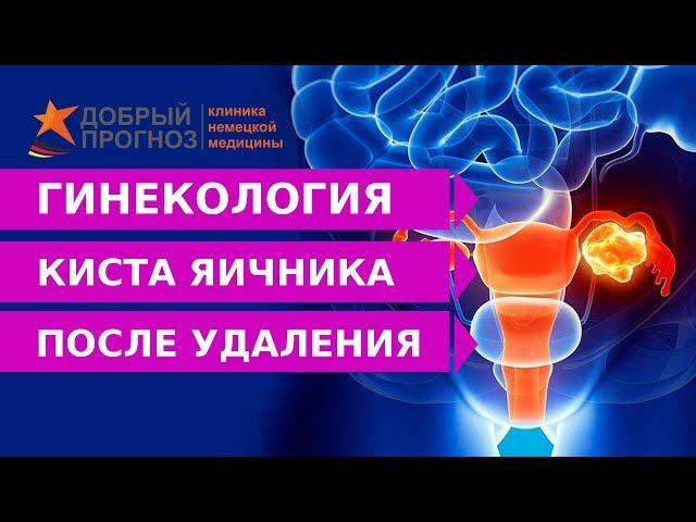 Что делать после УДАЛЕНИЯ КИСТЫ ЯИЧНИКА?