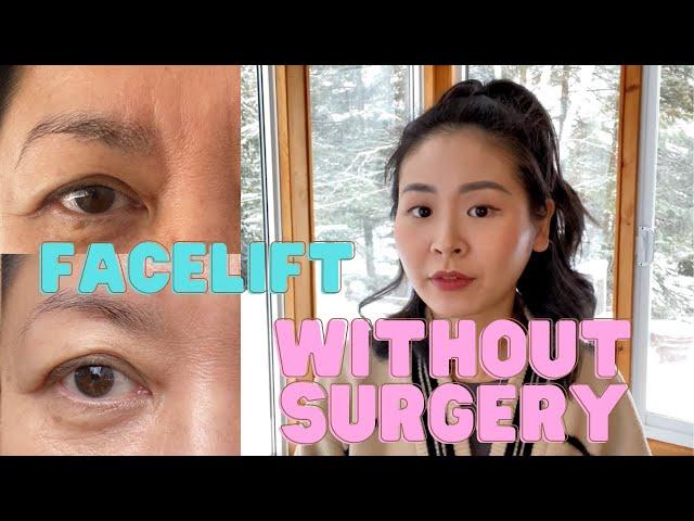 Natural Facelift Without Surgery! (all about non-surgical aesthetics treatments)