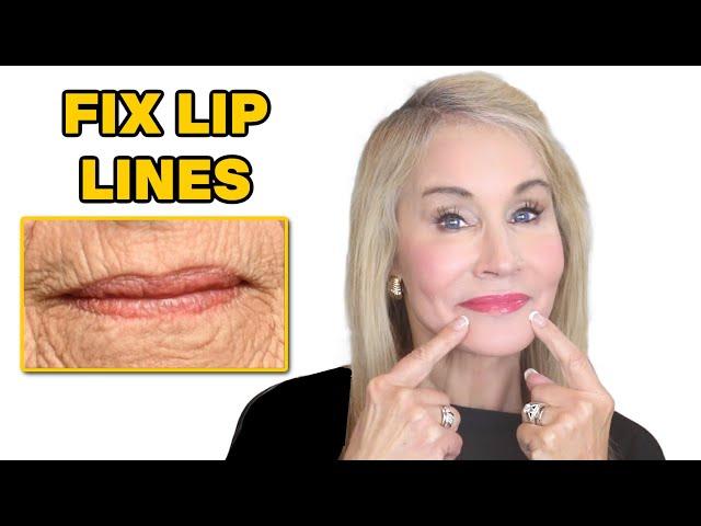 HOW TO FIX LIP LINES | TREATMENT FOR LIP WRINKLES