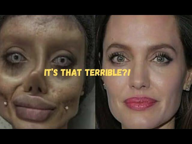 Famous Celebrities Unrecognizable After Plastic Surgery Gone Wrong | Then and Now 2024 #video