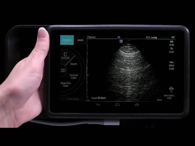 Sonosite iViz 5: Performing an Exam