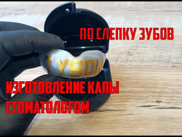 КАПА ДЛЯ БОКСА СПОРТИВНАЯ ИНДИВИДУАЛЬНАЯ ТРЕХСЛОЙНАЯ. ИЗГОТОВЛЕНИЕ КАПЫ СТОМАТОЛОГОМ  В ЛАБОРАТОРИИ
