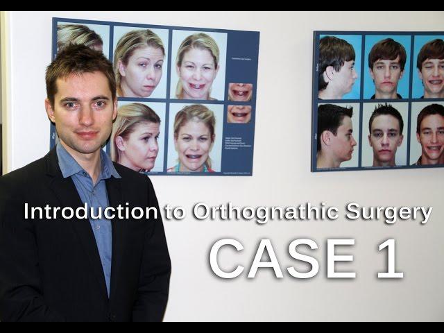 Lecture. Orthognathic Surgery. Introduction and CASE-1. Dr.Alexander V.Antipov, D.D.S.