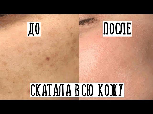 ПИЛИНГ СКАТКА для ЛИЦА || Что это такое и как работает?