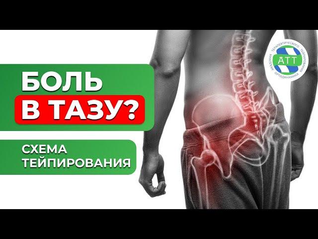  Боли в тазобедренном суставе. Тейпирование тазобедренного сустава. Триада тейпирования.