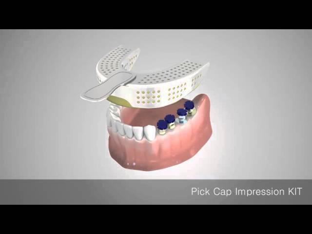 PickCap Kit Animation - Closed Tray Impression Technique Reinvented!