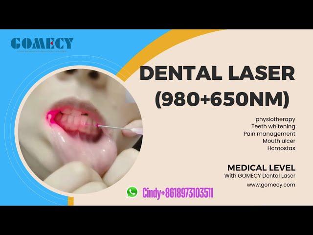 GOMECY dental laser medical level 980nm 650nm multifunctional equipment