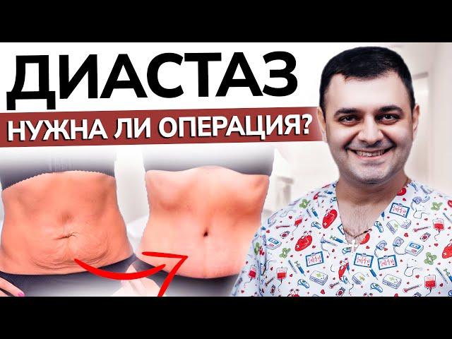 Как убрать ДИАСТАЗ | Причины диастаза и его лечение