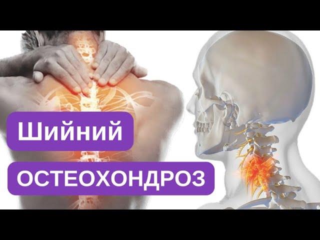 Остеохондроз шийного відділу хребта