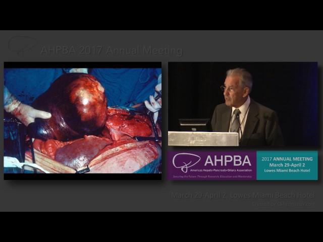 AHPBA 2017 Leslie H. Blumgart Historical Lecture. Presenter: Russell Strong, MD