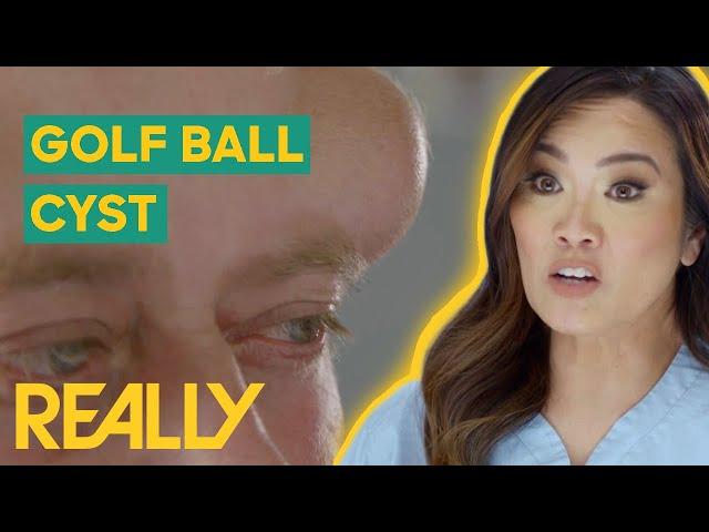 Dr. Lee Removes 16-Year-Old GOLF BALL-Sized Cyst | Dr. Pimple Popper