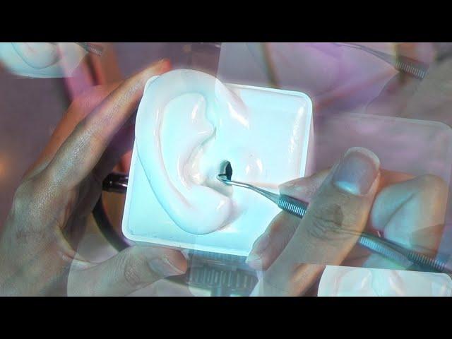 ASMR Professional Dental Hook Ear Cleaning (NO TALKING)