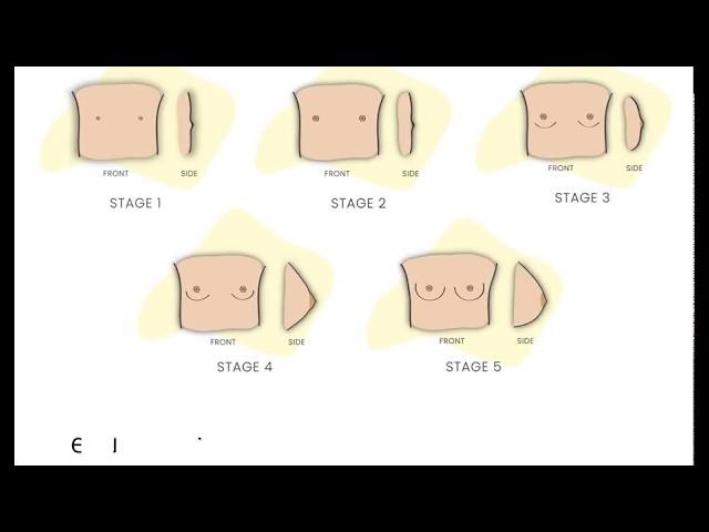 5 Stages of Breast Development | Beginner  Bras | My Adira