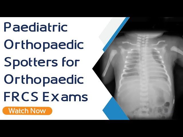 Paediatric Orthopaedic Spotters for Orthopaedic FRCS Exams | Orthopaedic Academy