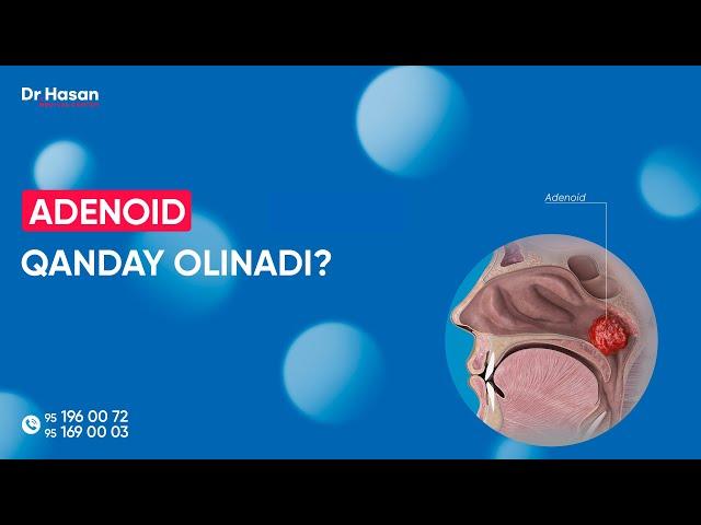 Adenoid qanday olinadi? | Doctor Hasan Medical Center