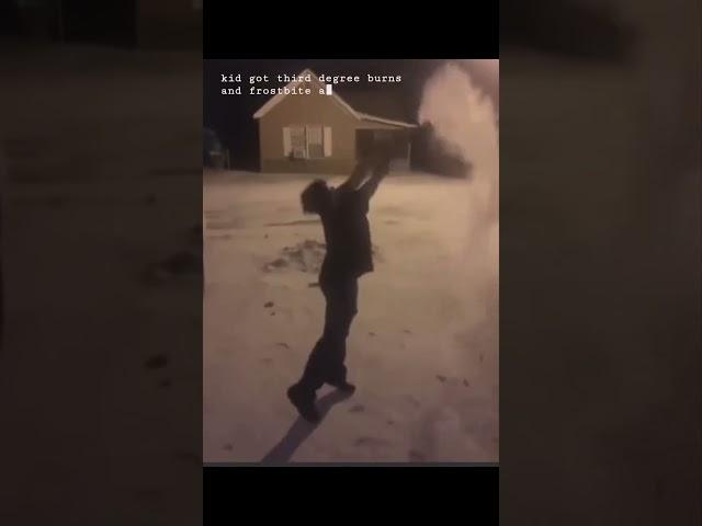 He accidentally dropped BOILING water on HIMSELF  | #shorts #aesthetic #fail