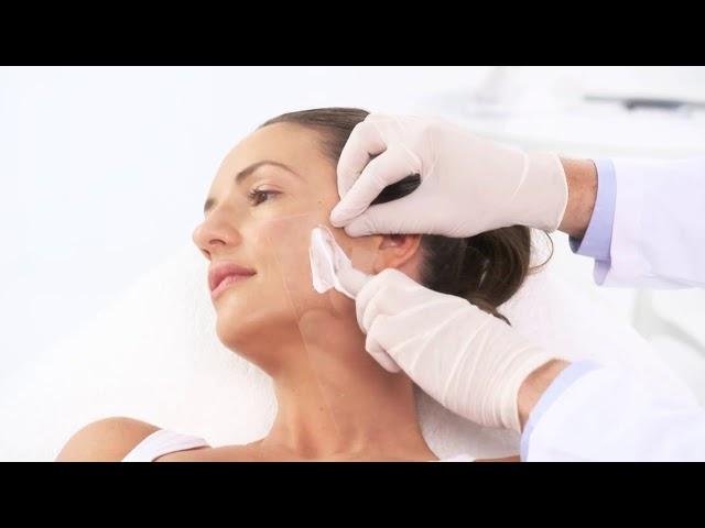 EndyMed Pro Intensif Microneedling Treatment