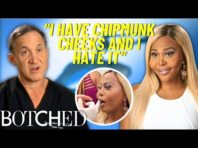 REJECTED By Botched: Transgender Model Seeks Help After Botched Silicone Injections | Botched | E!