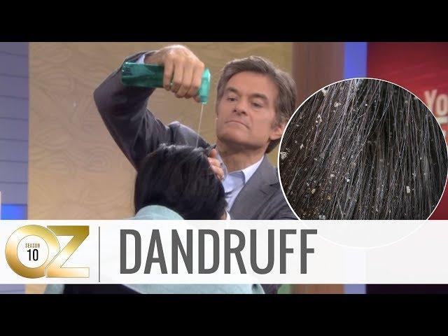 Quick and Easy Home Remedies For Dandruff