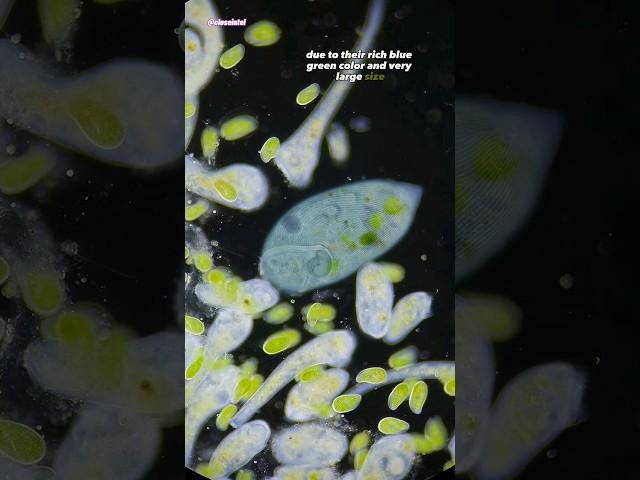 One Of The Largest Single Cell Organisms Under Microscope (Stentor coeruleus)