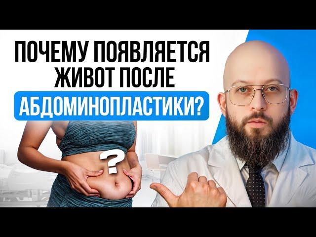 ВЕРНЕТСЯ ЛИ ЖИВОТ ПОСЛЕ АБДОМИНОПЛАСТИКИ? | ПОЧЕМУ ПОЯВЛЯЕТСЯ ЖИВОТ ПОСЛЕ АБДОМИНОПЛАСТИКИ?