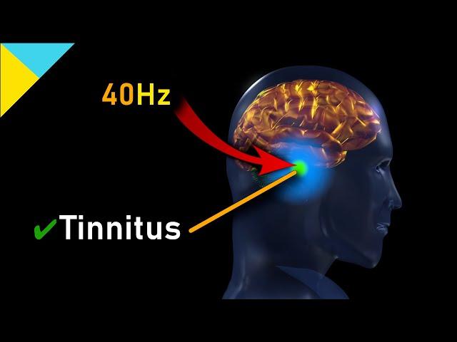 Tinnitus "MIRACLE" Quantum Healing Frequency HAS ARRIVED! 40Hz • Gamma Waves