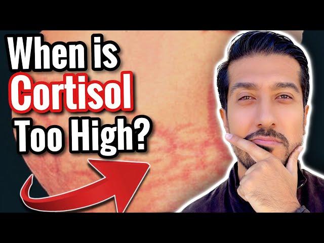 5 Signs of High Cortisol to NOT IGNORE | What Lowers Cortisol?