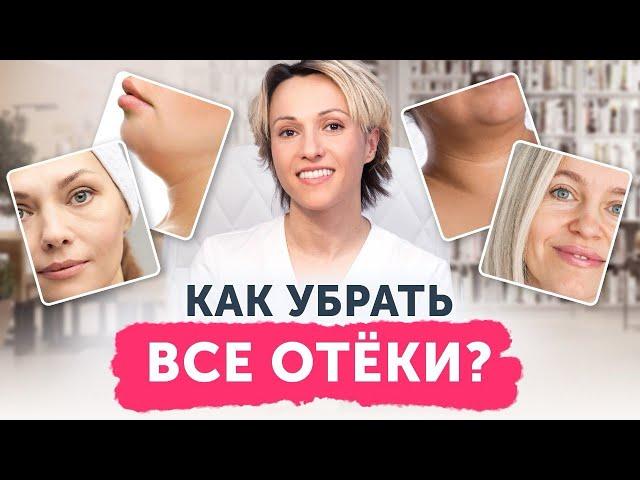 Как убрать ВСЕ отёки? 6 видов отёков лица и борьба с ними