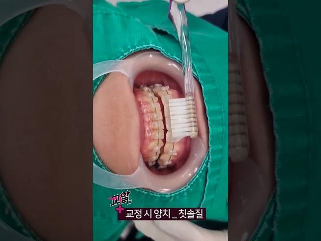 교정양치법 #교정칫솔 교정양치의 정석