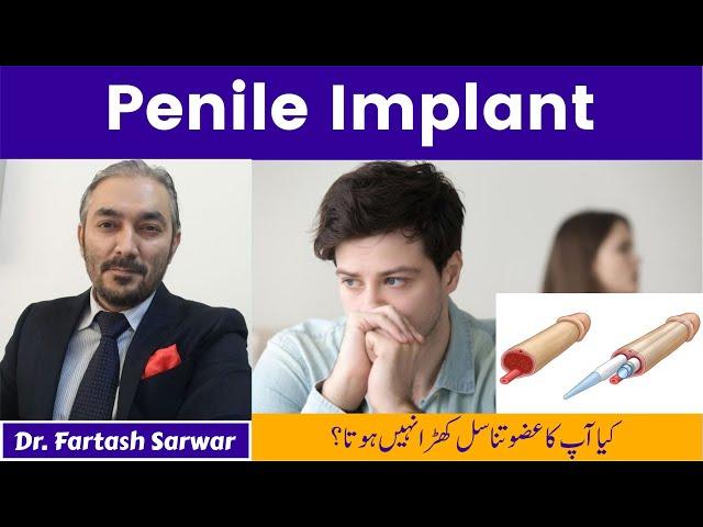 Penile Implant Benefits | Penile Implant Surgery | Dr. Fartash Sarwar | Best Urologist | Urdu/Hindi