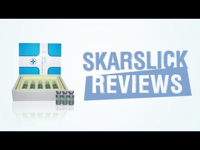 EZ SHOP - skarslick review