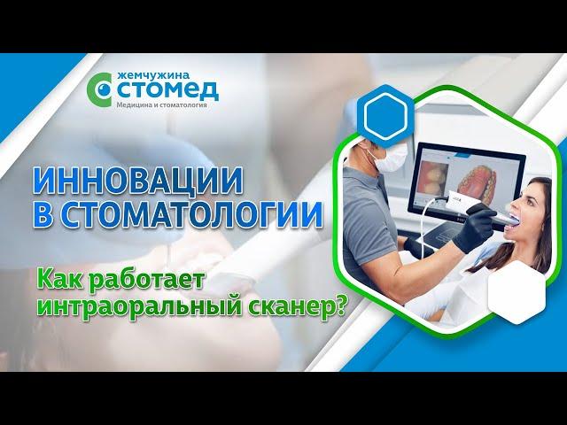 Инновации в стоматологии. Как работает интраоральный сканер?