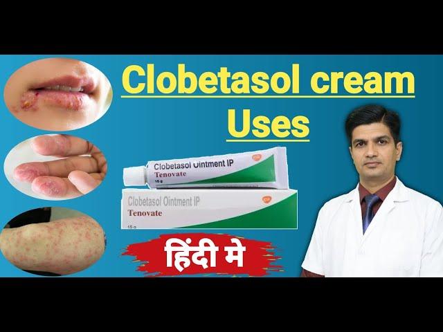 Clobetasol Propionate cream uses | Tenovate cream Uses in hindi