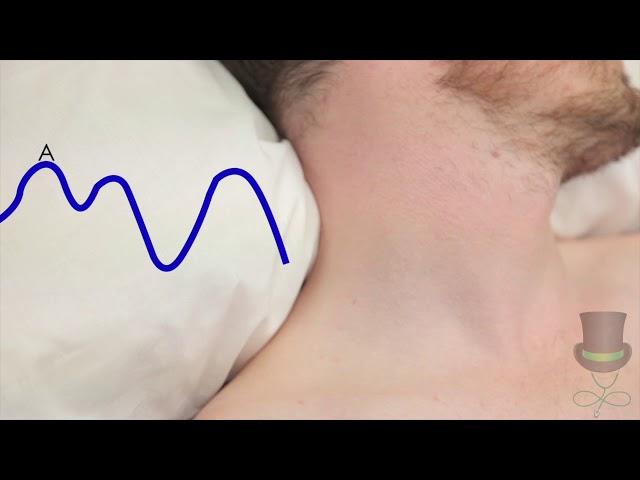 Cardiology - Assessing the Jugular Venous Pulse