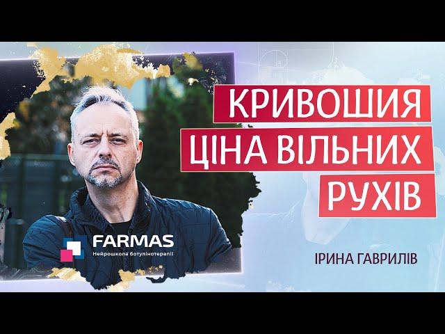 Кривошия. Ціна вільних рухів