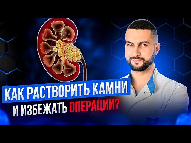 Растворение камней в почках | Еда, вода и препараты