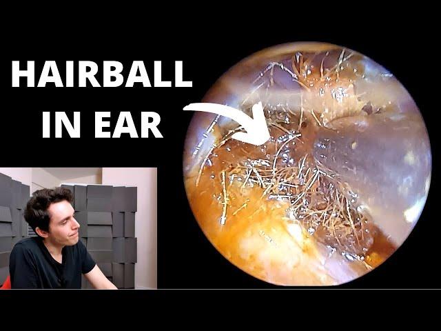 Painful Hairball Stuck In Ear Canal