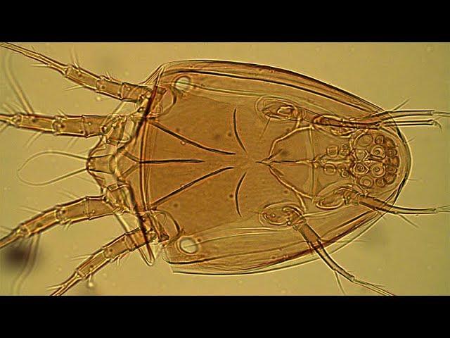 Deutonymphs of the mite Bonomoia sibirica Wirth, 2016