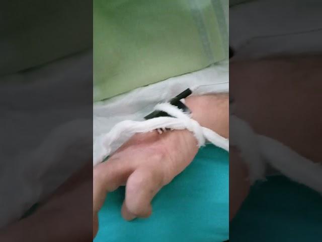 Myostimulator STIMEL-01M