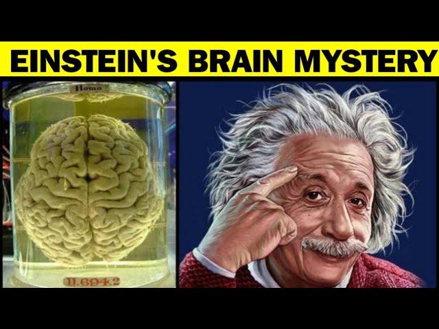 Was Einstein's Brain Different from Ours?