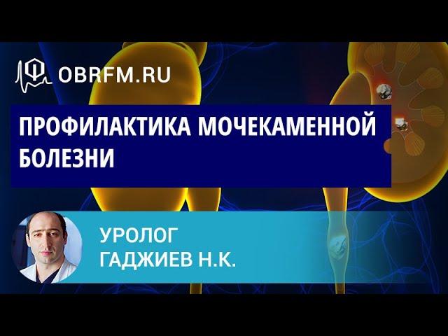 Уролог Гаджиев Н.К.: Профилактика мочекаменной болезни