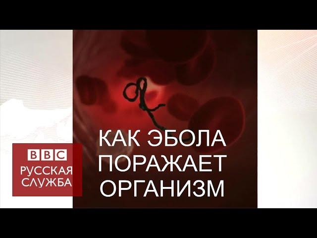 #BBCShorts: Как Эбола поражает организм - BBC Russian