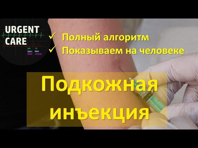 Подкожная инъекция. Техника и алгоритм