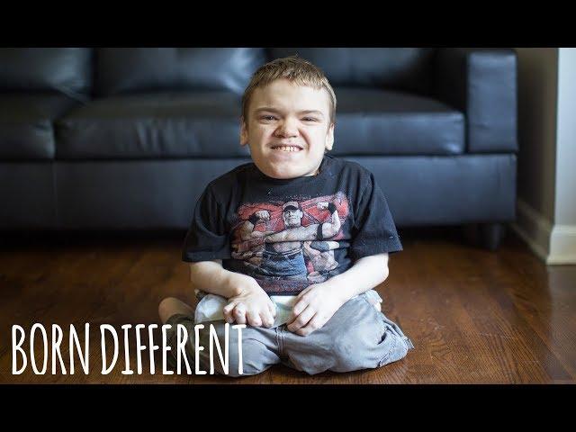 The 18-Year-Old Gamer Who Looks Like A Child | BORN DIFFERENT