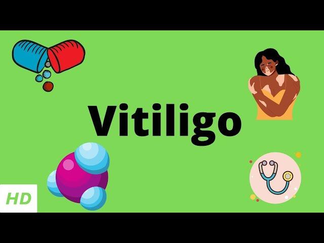 Vitiligo, Causes, Signs and Symptoms, Diagnosis and Treatment.