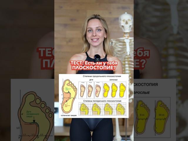 ТЕСТ: Проверь, если ли у тебя Плоскостопие?