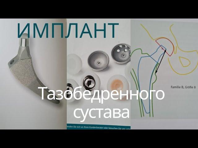 Паспорт импланта Тазобедренного сустава. Zimmer