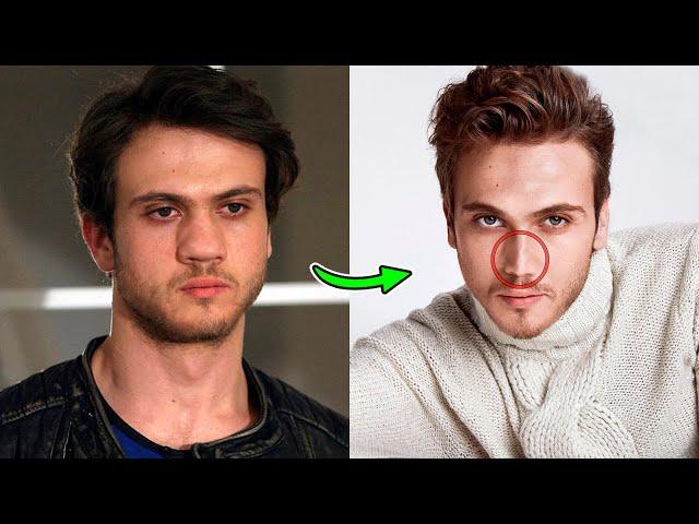 Turkish actors who have undergone plastic surgery