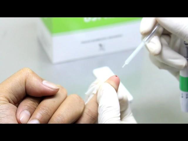 Tata Cara Penggunaan Alat UJI (Rapid Test) HIV PT Pakar Biomedika Indonesia